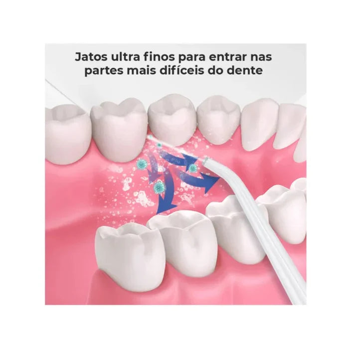 O Segredo do Sorriso Perfeito: Irrigador Bucal Portátil Premium!